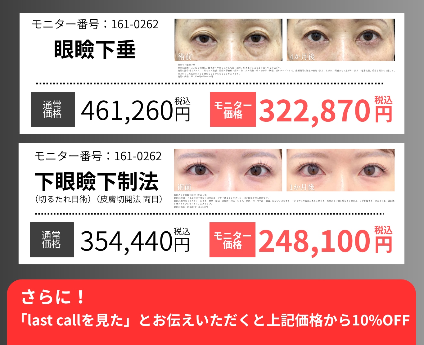目の開き改善・印象を変えたい