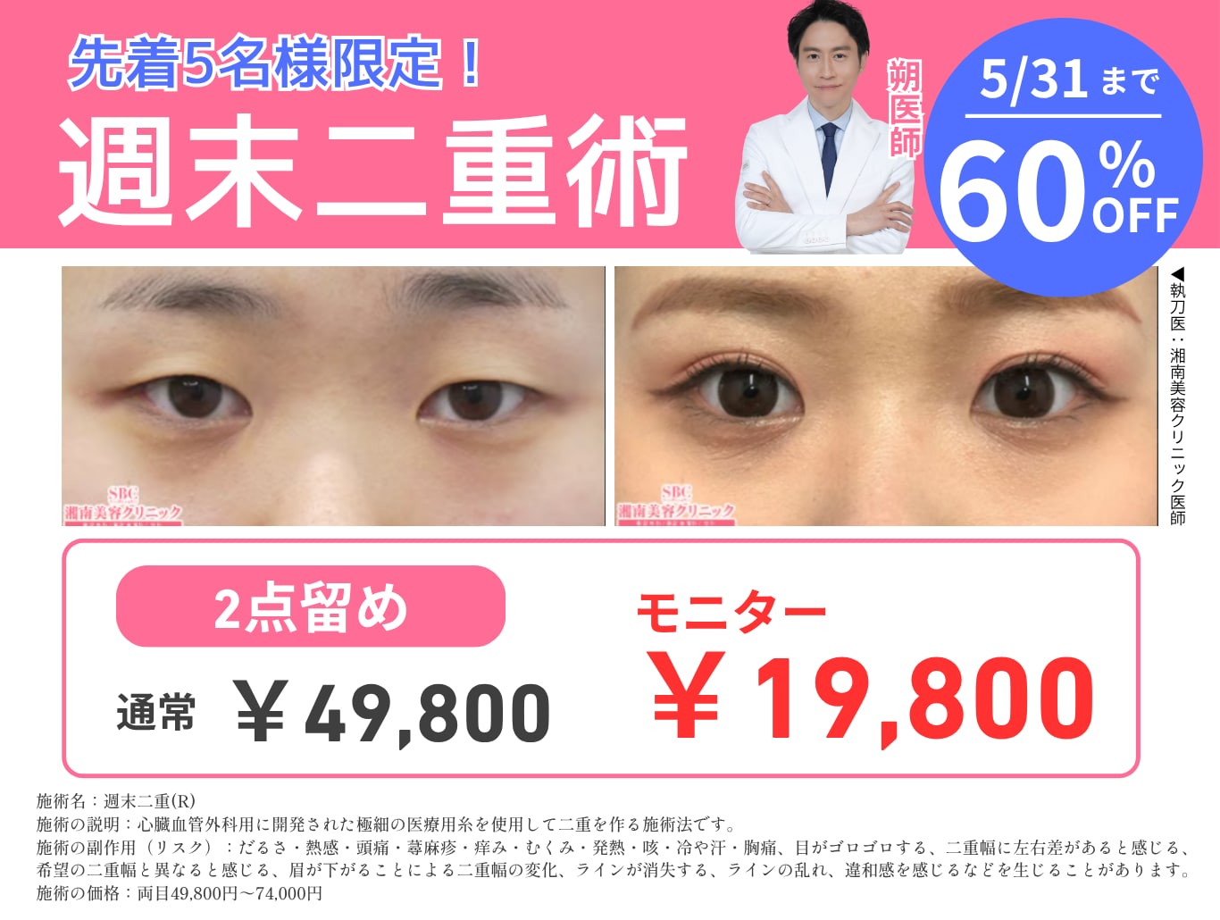 5/31まで！60%OFF！