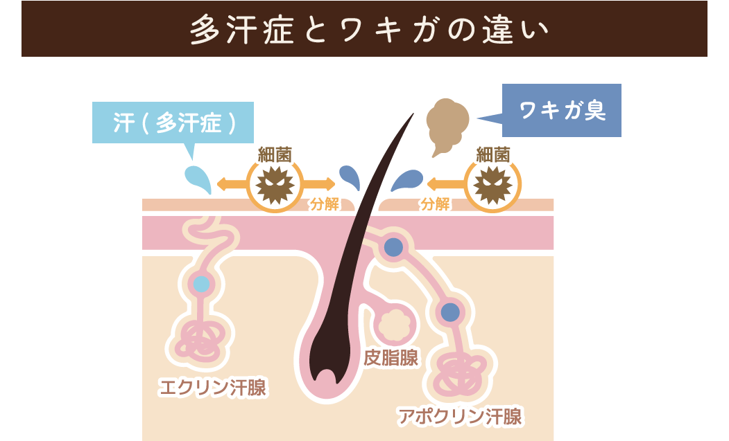 多汗症とワキガの違い