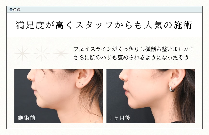 満足度の高い【うるコラ】