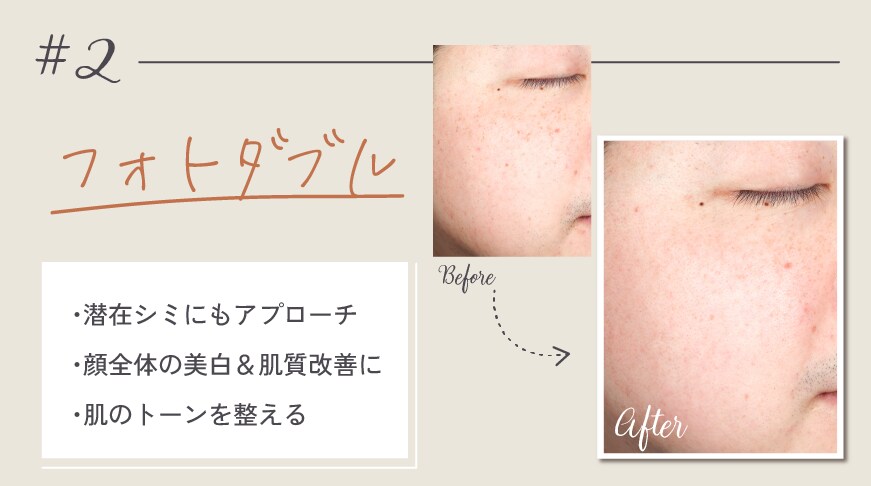 ②フォトダブル