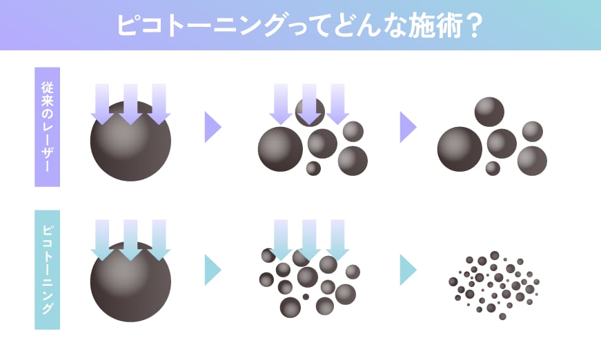 従来のレーザーとはここが違う！
