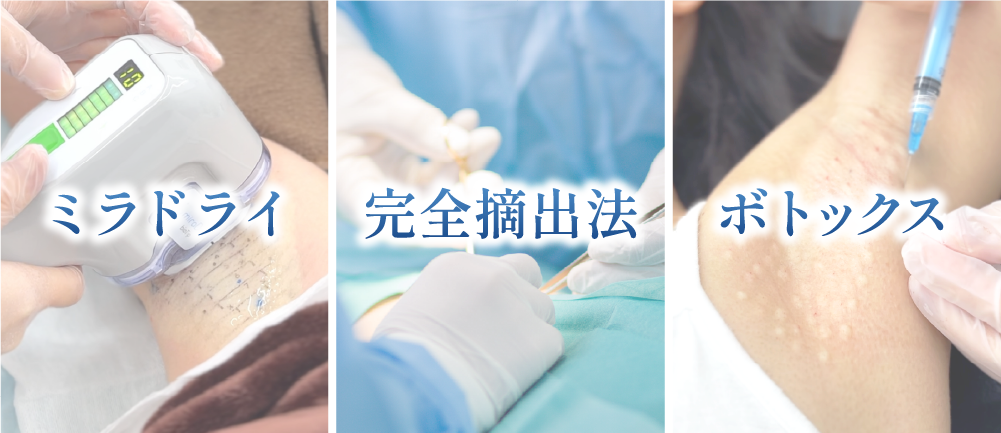 完全摘出法と脇汗ボトックスと比較！