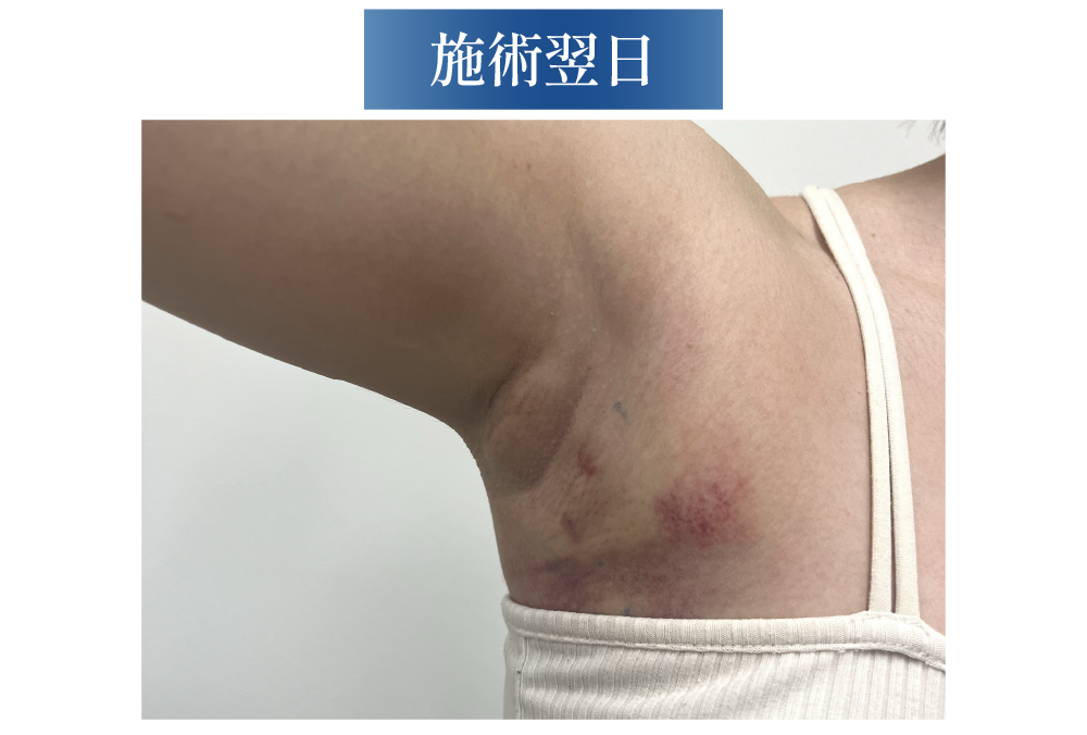 ダウンタイムはどれくらい？