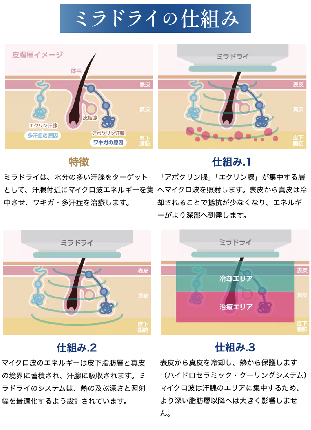 ミラドライの仕組み