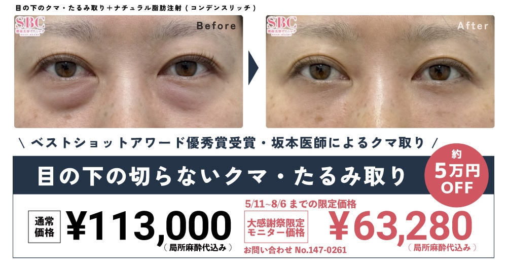 0511外科CP価格_2605_5周年モニターCP_クマトリ