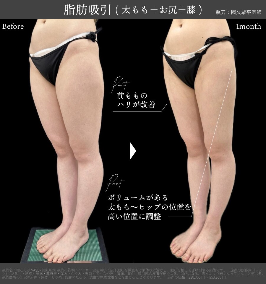 スタイルを良く見せるボリューム調整