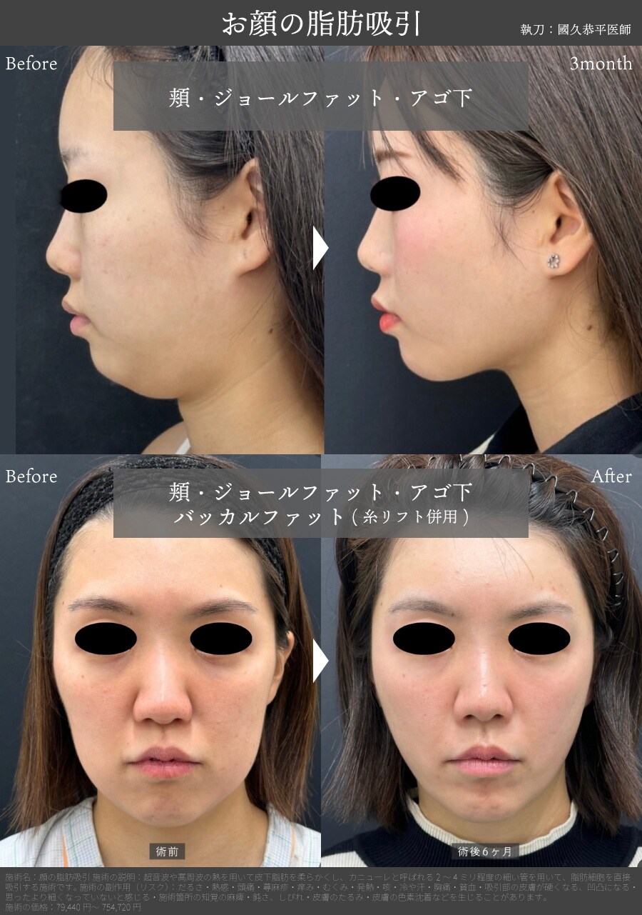 骨格に沿った「360度どこから見ても美しい」造形