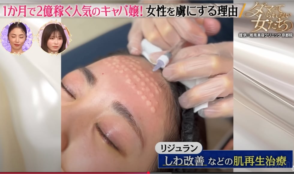 Abema TV「ダマってられない女たち」で施術風景が放送