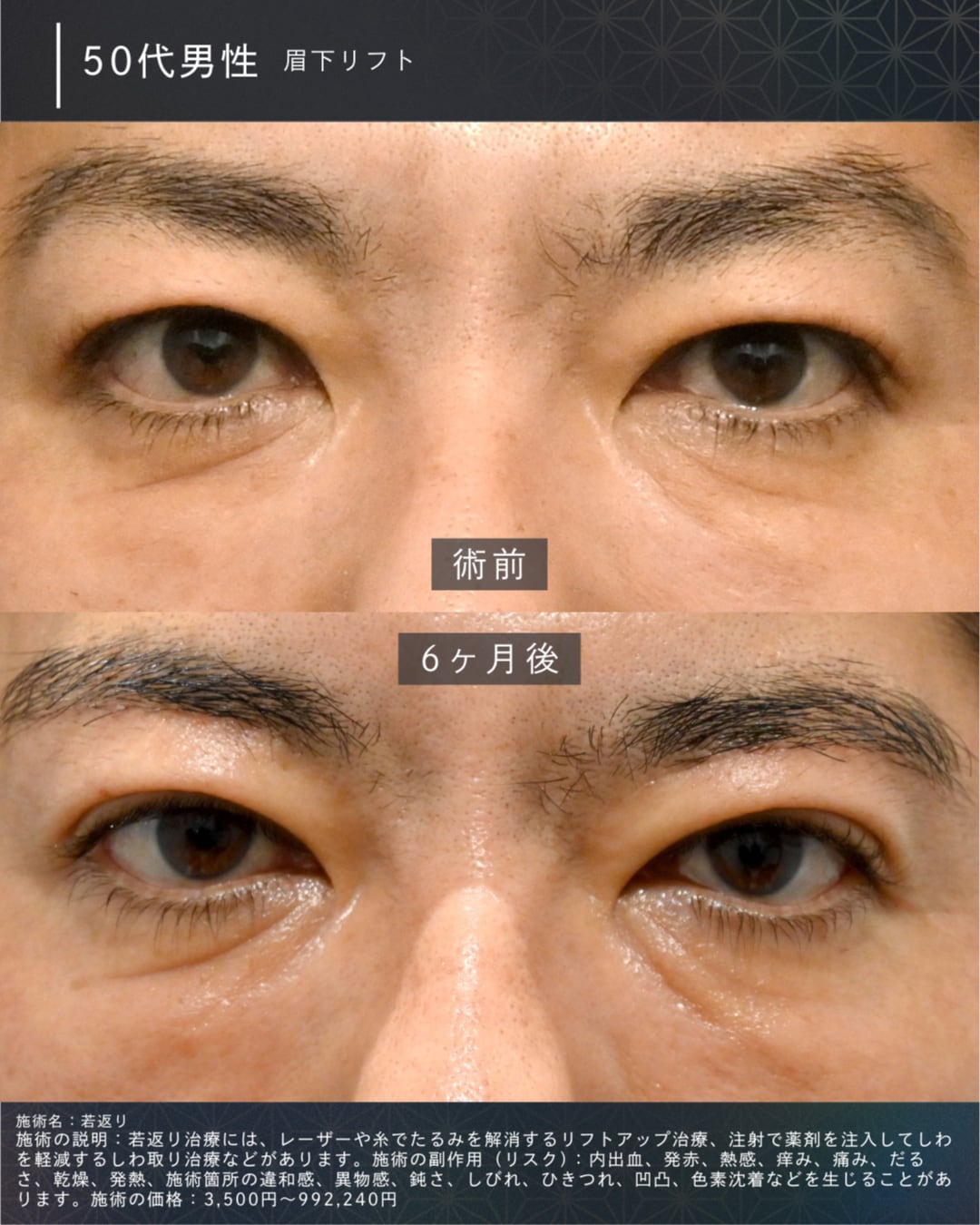 50代男性の症例
