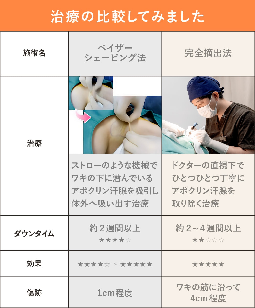 【比較解説】<br />
切る多汗症治療、何が違うの？