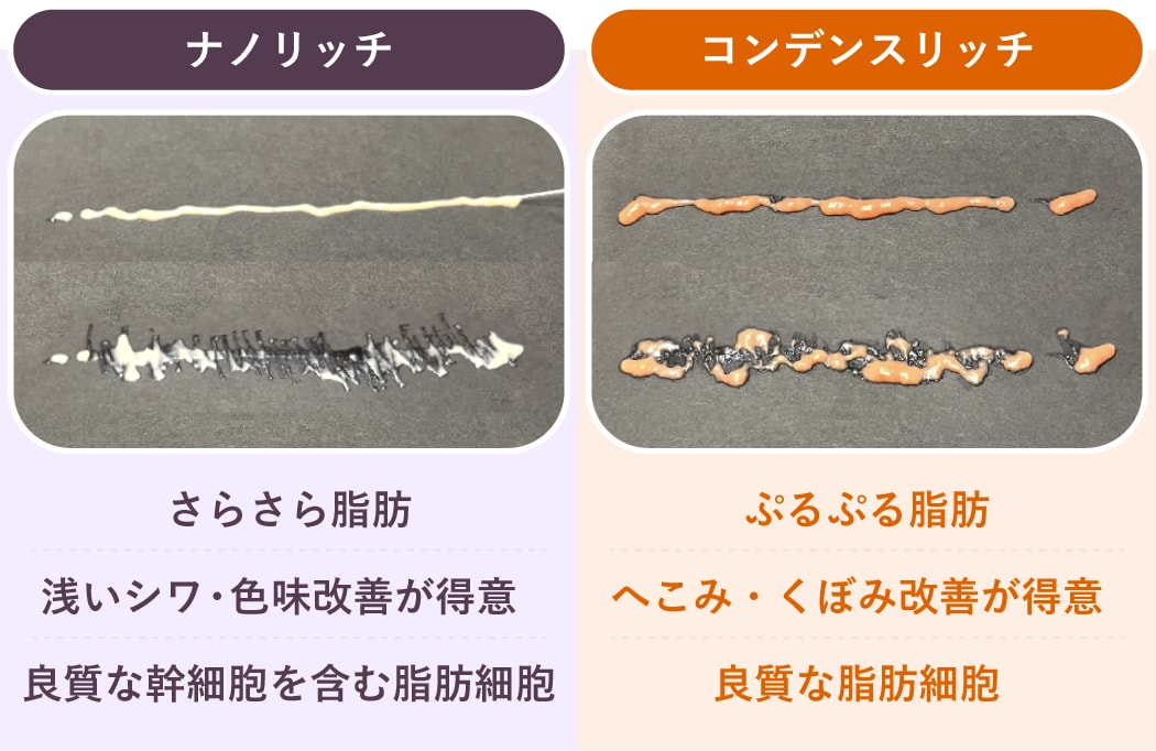 【ボリュームUP】と【肌質改善】<br />
目的に合わせて使い分ける高濃度脂肪