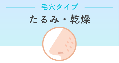 [ 治療の方向性 ]<br />
<strong>コラーゲン増生・引き締め・保湿</strong>