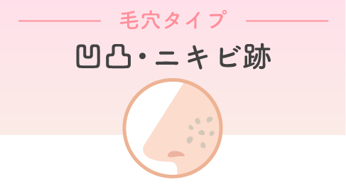 [ 治療の方向性 ]<br />
<strong>肌再生・真皮治療</strong>
