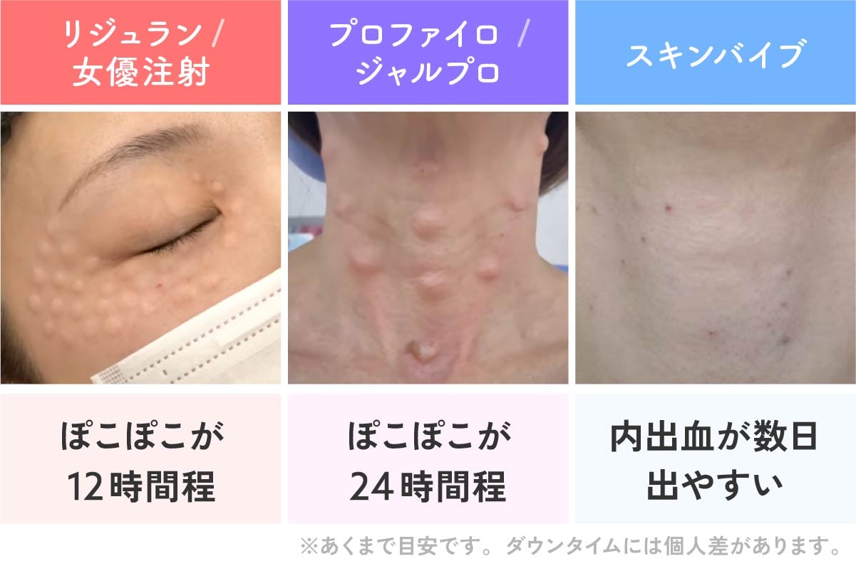 ダウンタイムの経過目安図