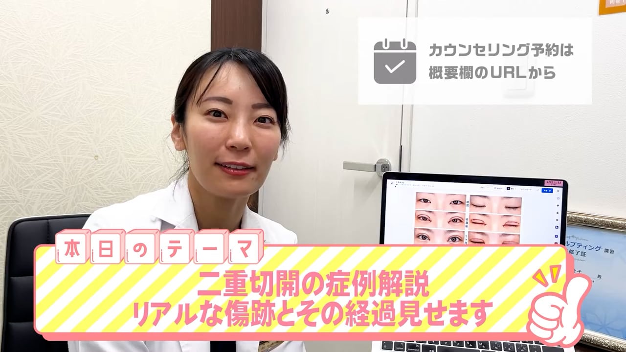 ダウンタイムの正しい知識が安心につながる