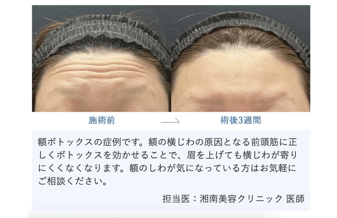 額