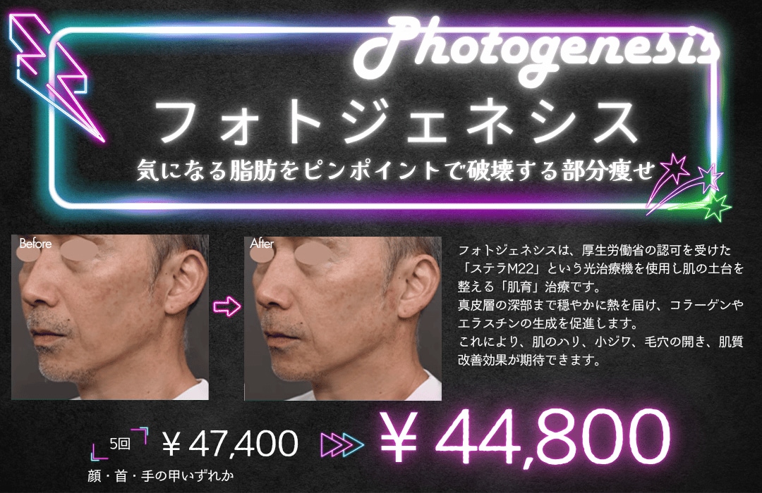 フォトジェネシス
