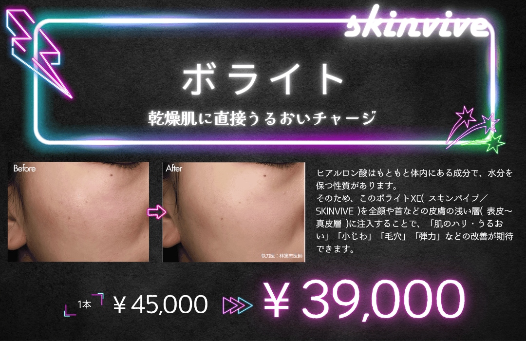 ボライト
