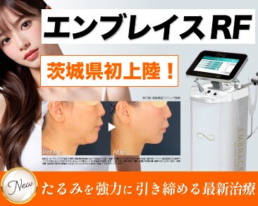 エンブレイスRF – 最先端のタイトニング治療!魅力とその効果とは?湘南美容クリニック水戸院