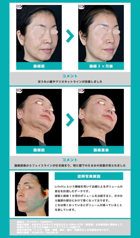 施術効果を症例でチェック！