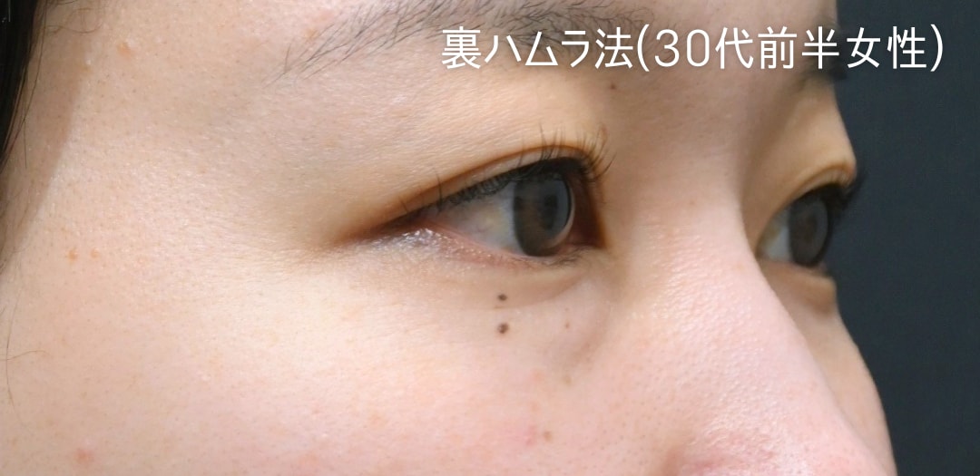 術前