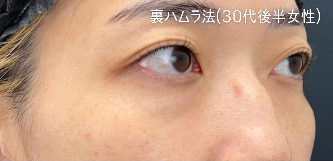 術前