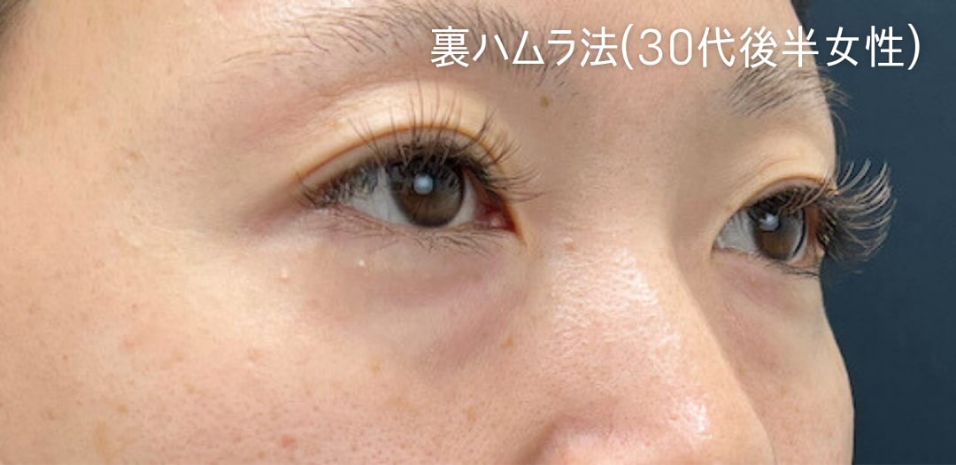 術前