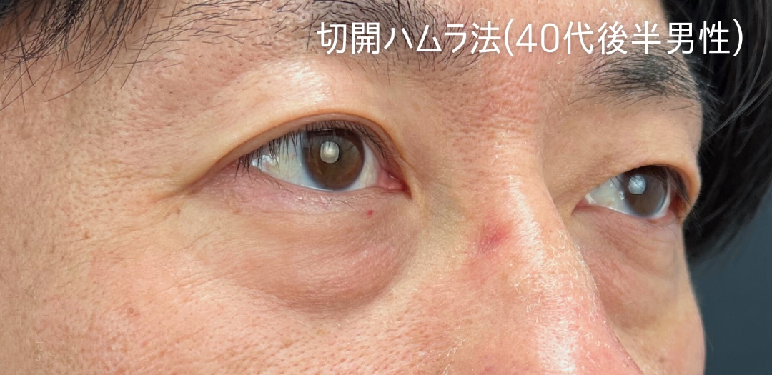 術前