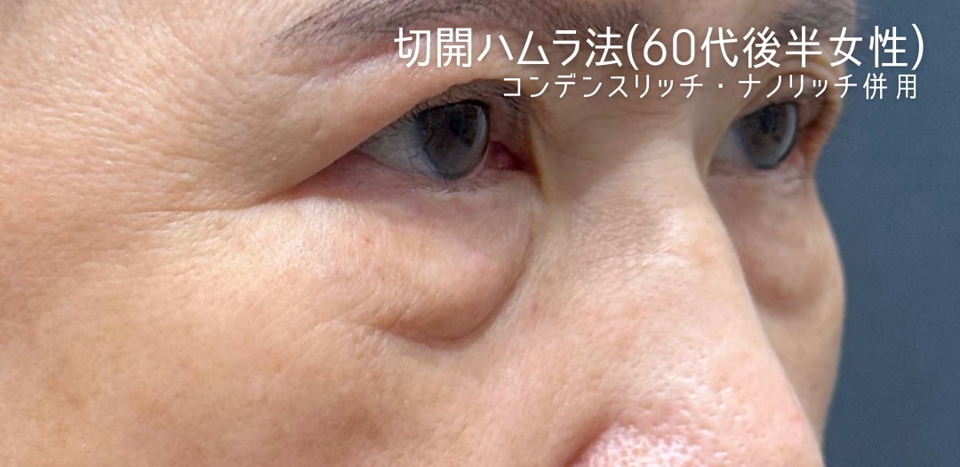 術前