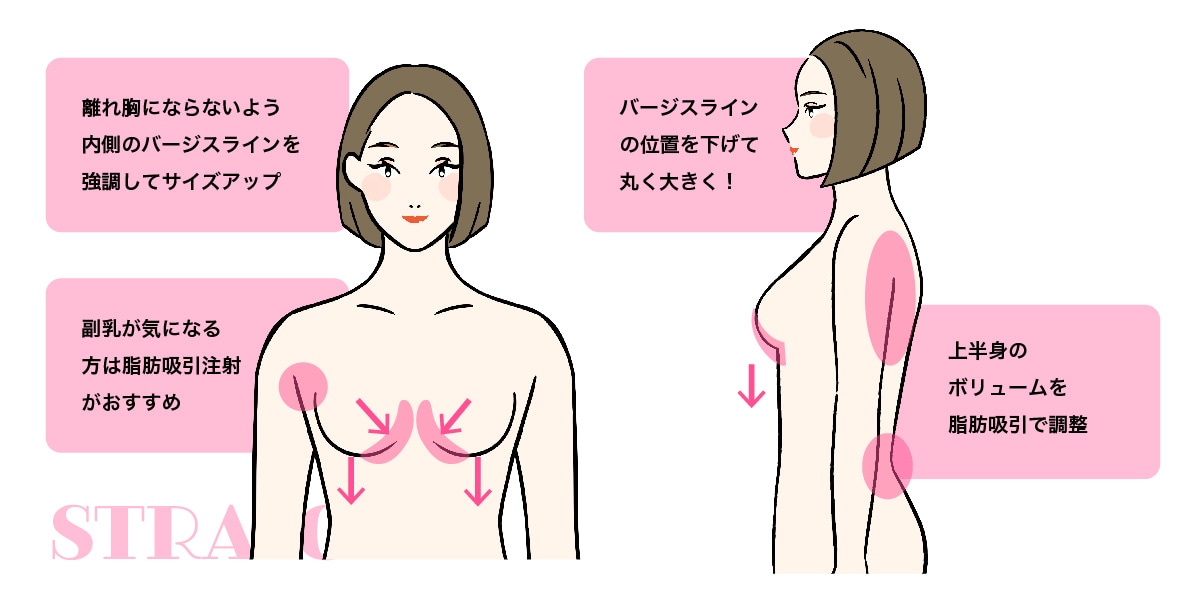 ストレートタイプ