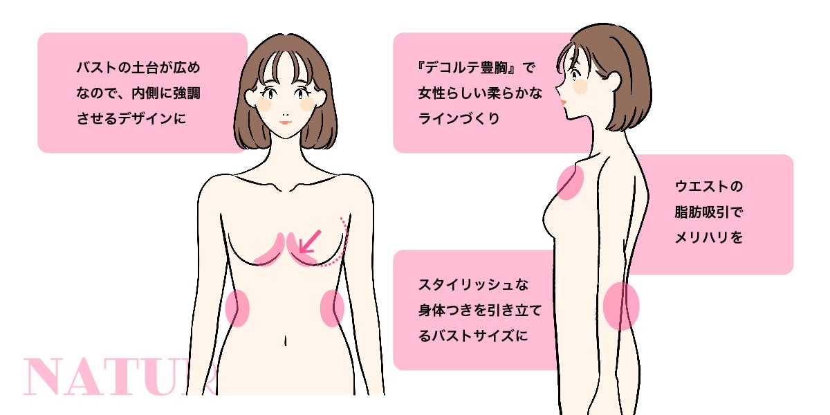 ナチュラルタイプ
