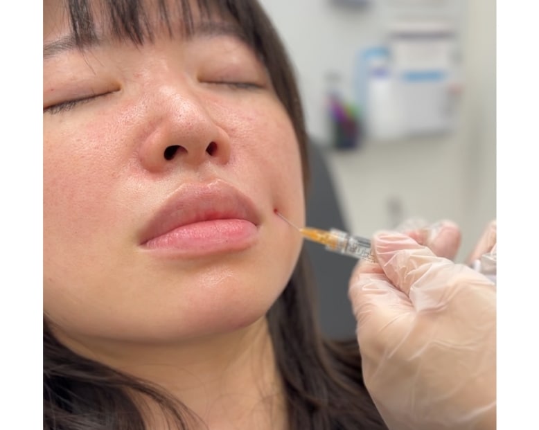 ヒアルロン酸注入の痛みは？