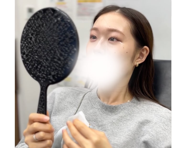 ヒアルロン酸注入後に気をつけることは？