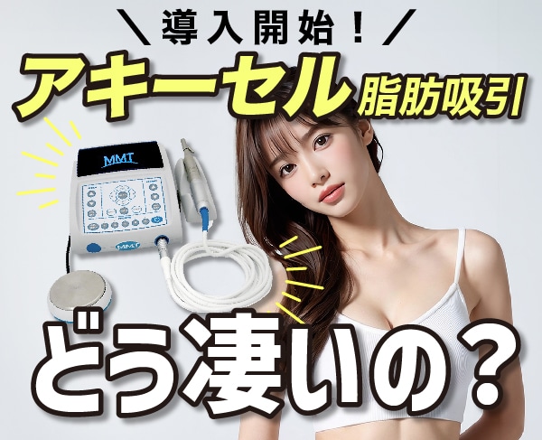 ダウンタイム最小限で大人気のアキーセル脂肪吸引が武蔵小杉院に！