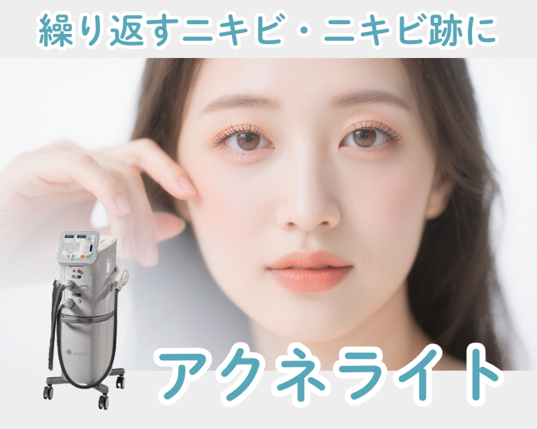繰り返すニキビ・ニキビ跡にアクネライト。武蔵小杉で肌荒れを治す方法教えます!