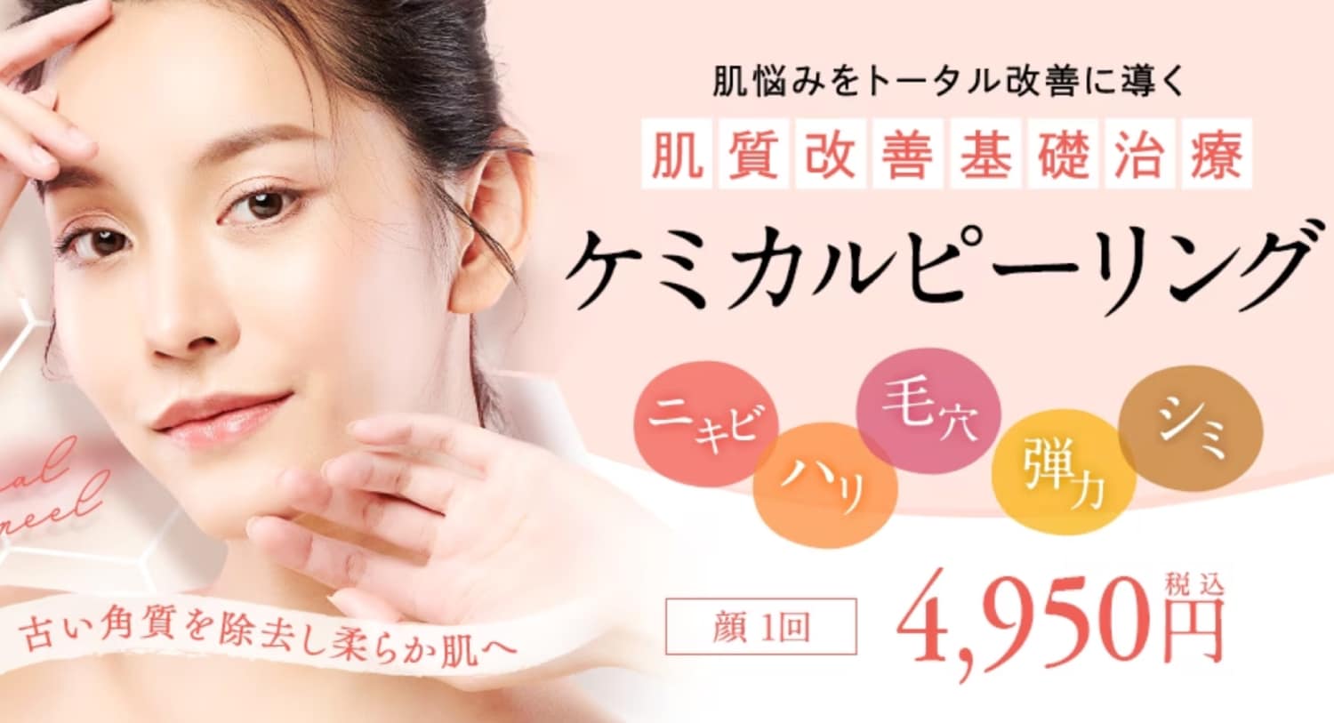 ケミカルピーリング