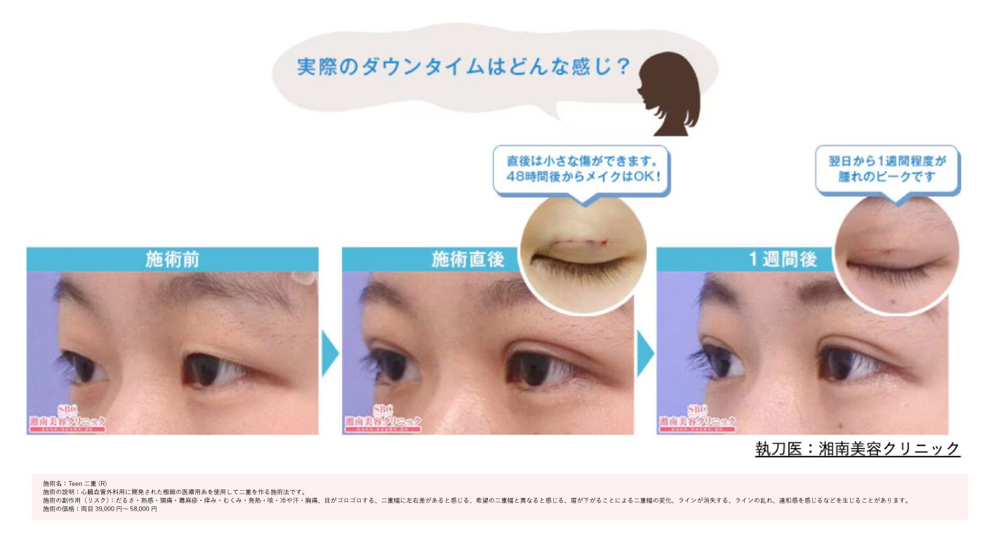長期のお休み不要で、バレづらい！