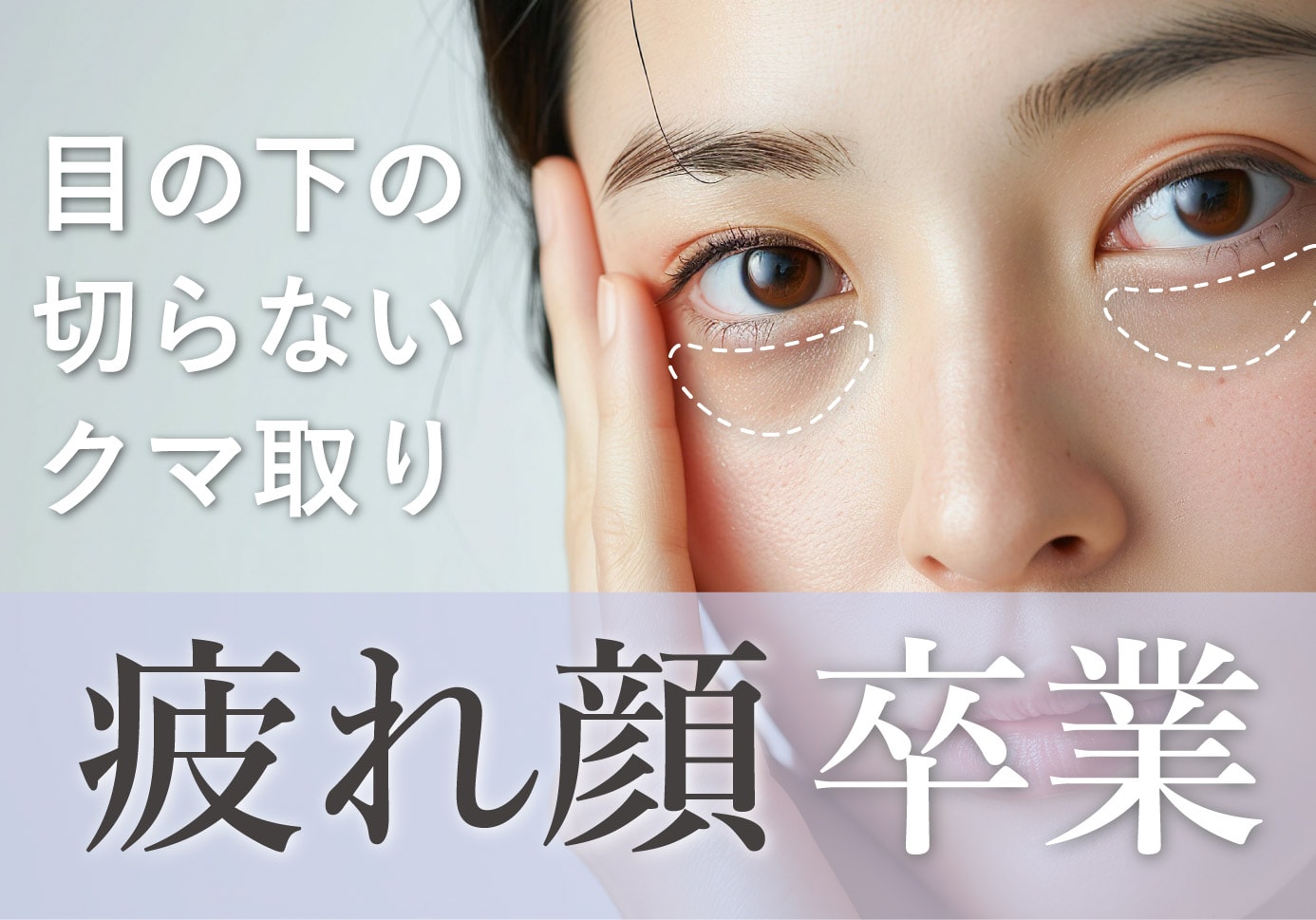 目の下の切らない「クマ・たるみ取り」