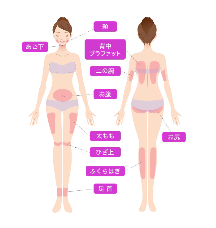 効果の持続時間と治療場所