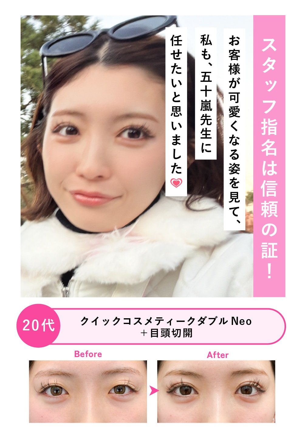 20代女性