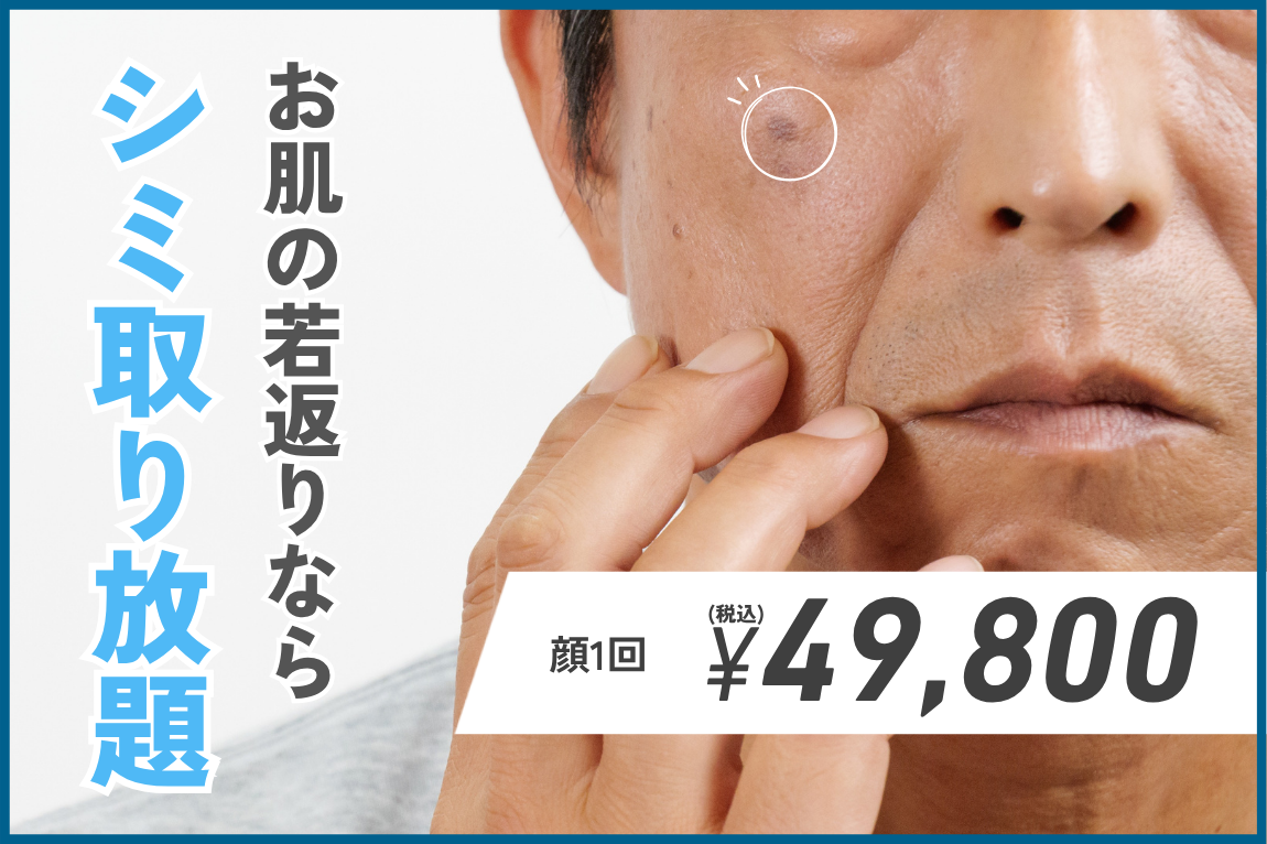 シミを取るだけで若返り！