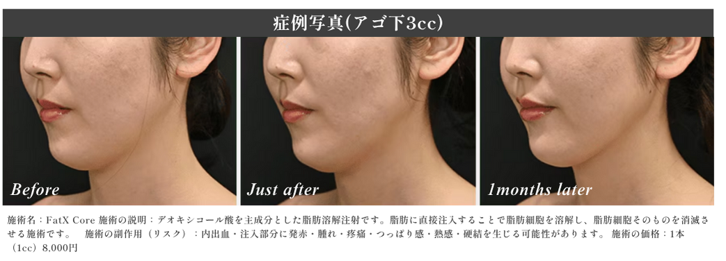 実際の効果をチェック！