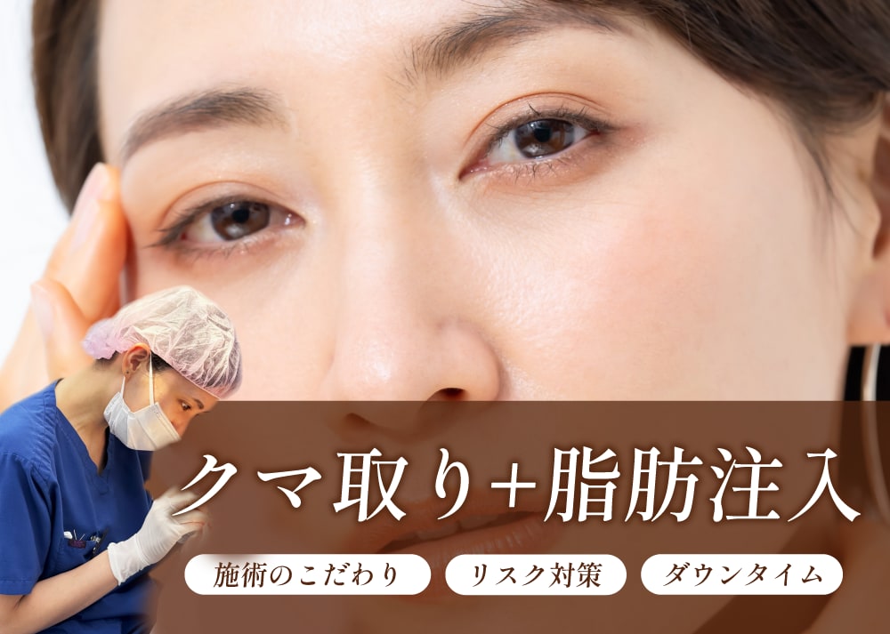 【クマ取り＋脂肪注入】新潟長岡で目元の若返りなら田中真緒医師！/湘南美容クリニック長岡院