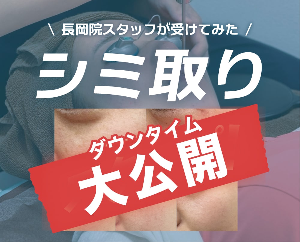 【新潟/長岡でシミ取り】気になるダウンタイム経過を大公開！/湘南美容クリニック長岡院