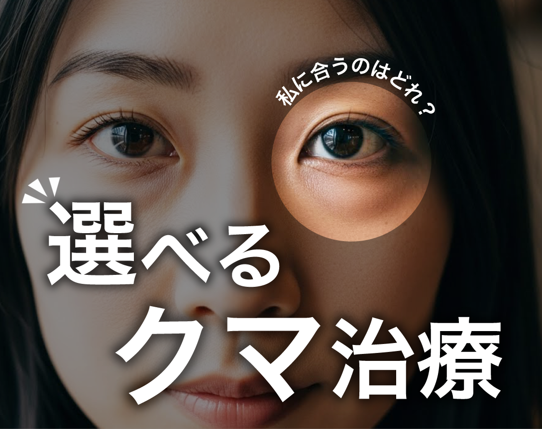 【選べるクマ治療】目の下のクマを改善するにはどの治療がいい？/湘南美容クリニック長岡院