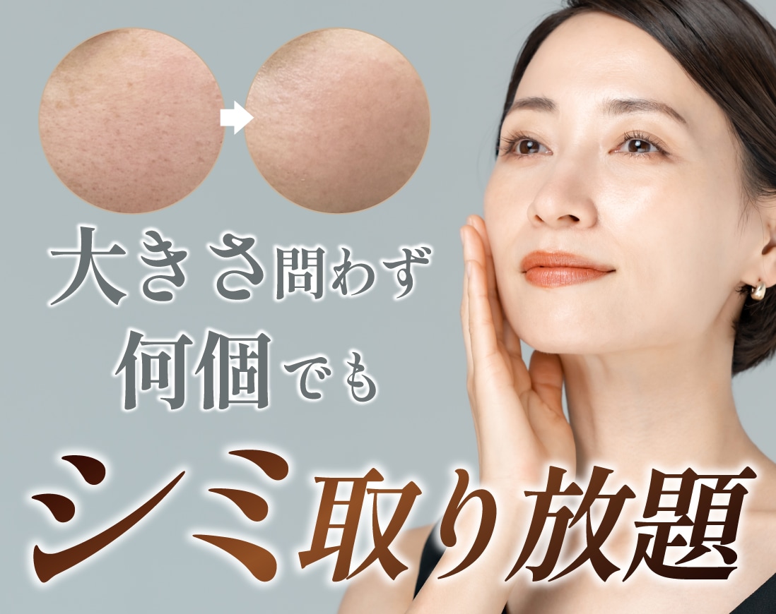 新潟、長岡でお得にシミ取り放題をするなら湘南美容クリニック長岡院！