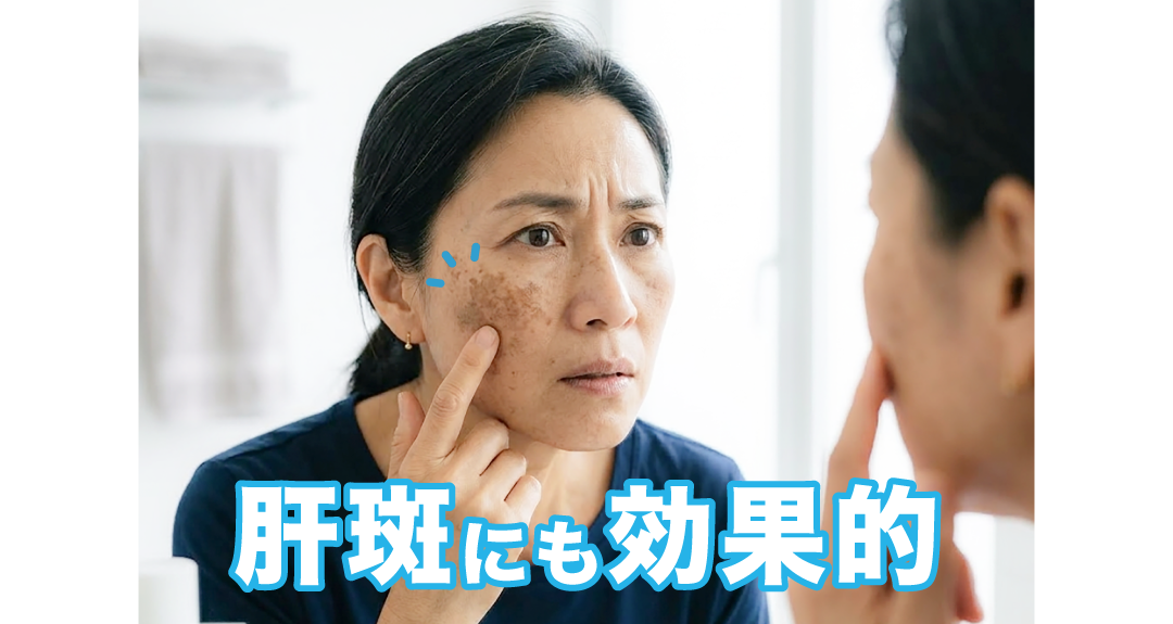 肝斑があってもできる肌治療