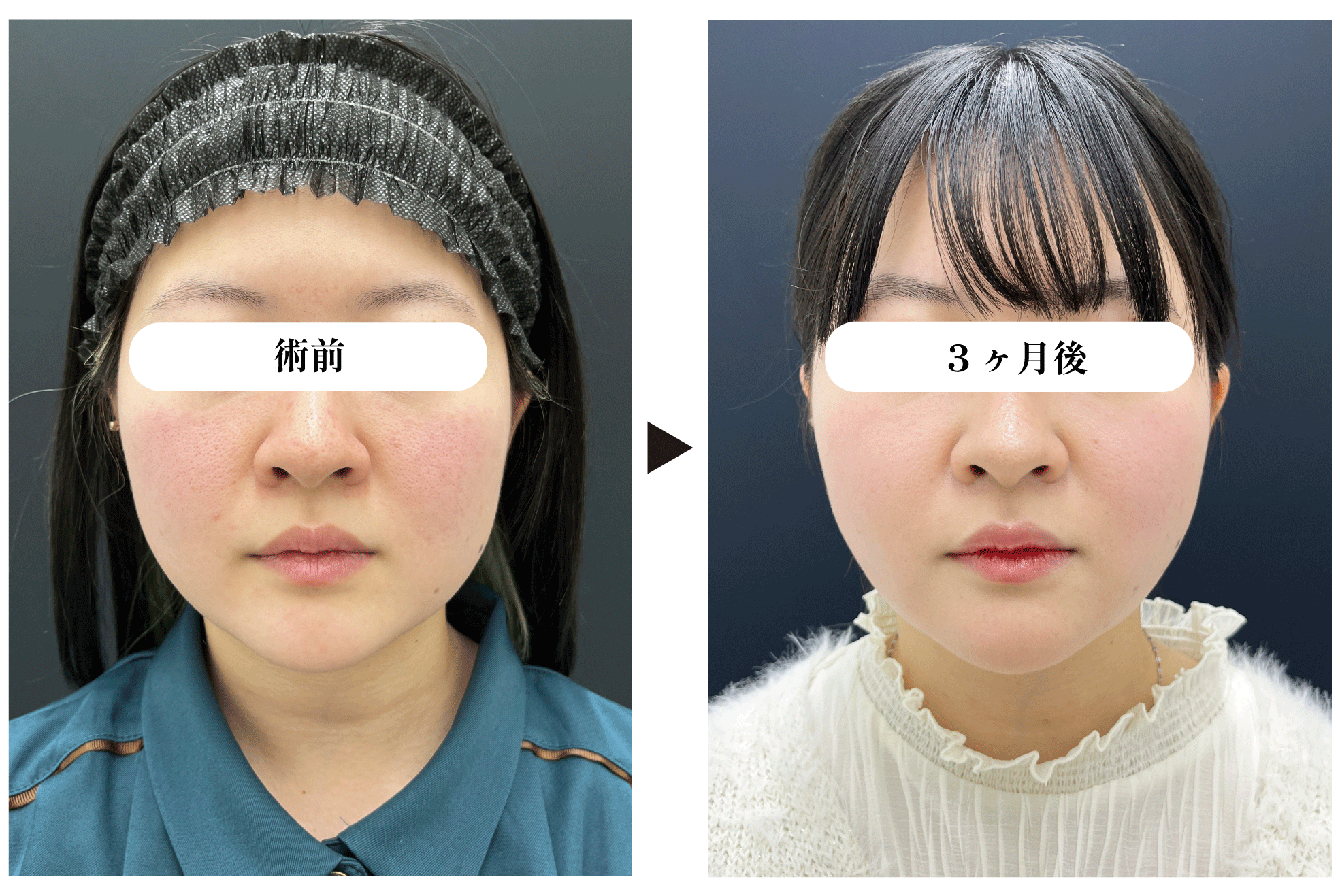 20代女性