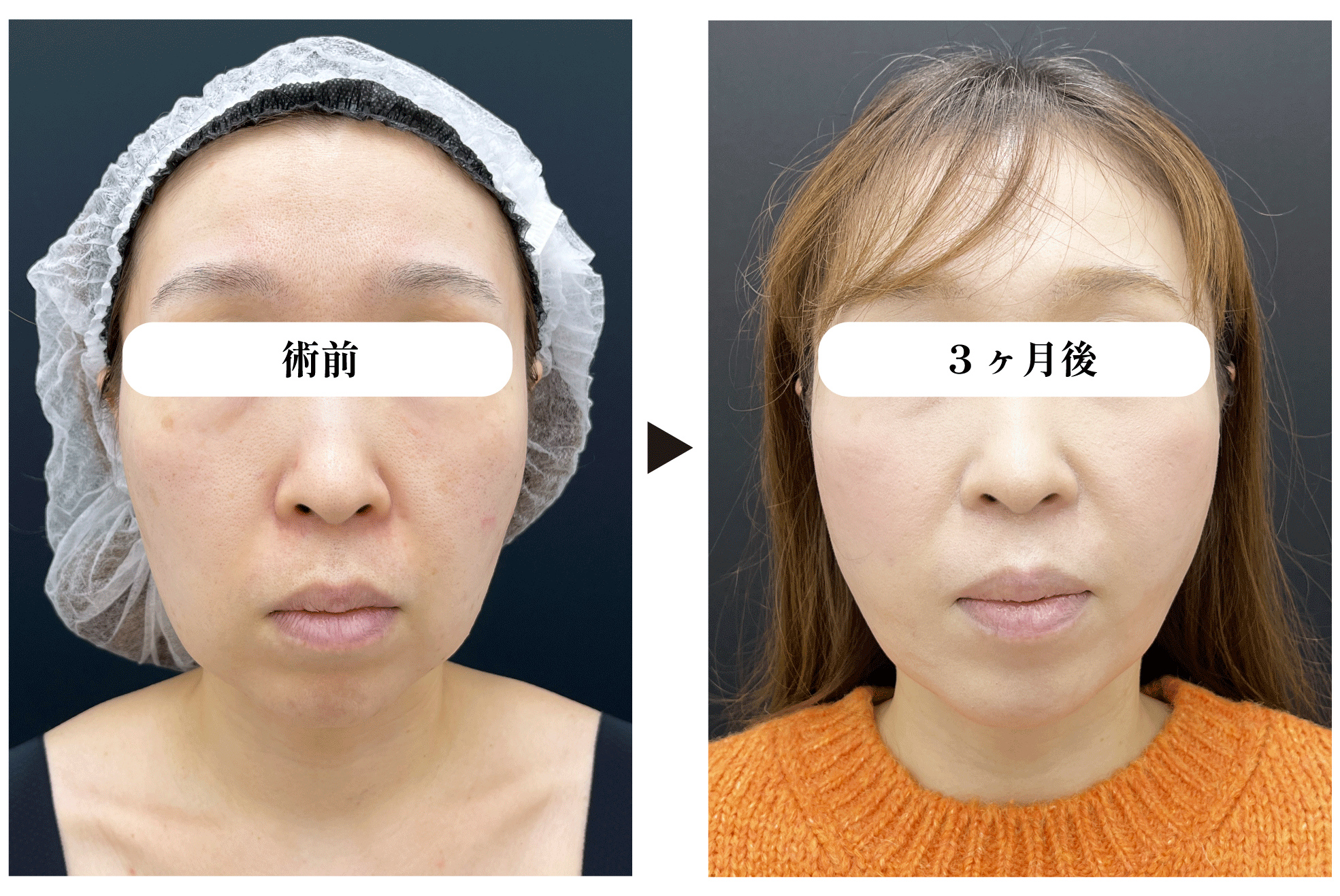 40代女性